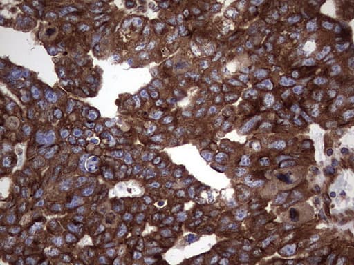 NUMB Antibody (aa1-365, clone OTI1B5)