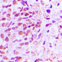 RELA / NFKB p65 Antibody (C-Terminus)