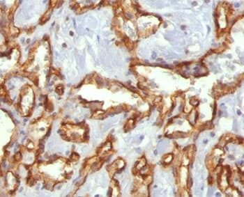 PECAM-1 / CD31 Antibody (clone C31.3, Ready-to-Use)