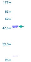 Human PRDX2 / Peroxiredoxin 2 Protein (Recombinant GST)