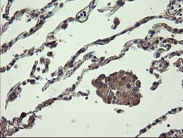 UBE2J1 Antibody (clone OTI3E6)