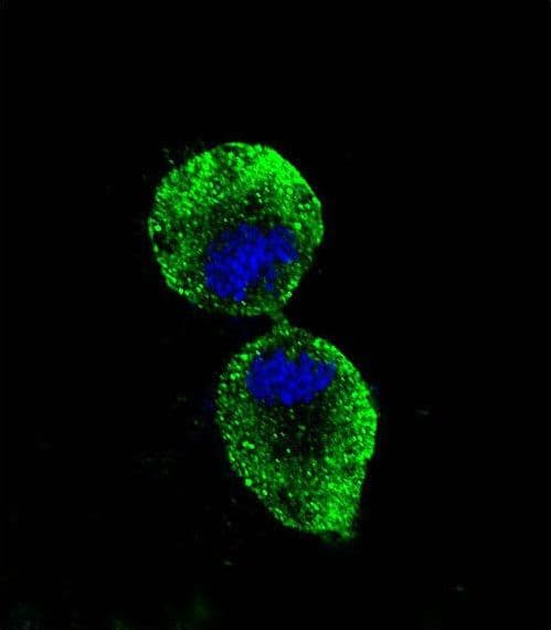 PathPlus™ ALDH1A1 / ALDH1 Antibody