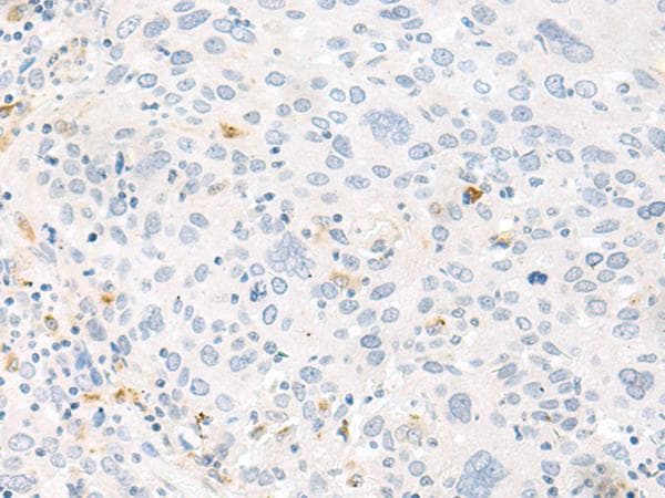 Polyclonal Rabbit anti-Human FABP4 / AP2 Antibody (IHC, WB)