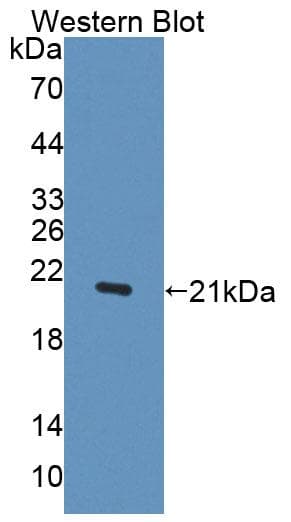 IFNA1 / Interferon Alpha 1 Antibody