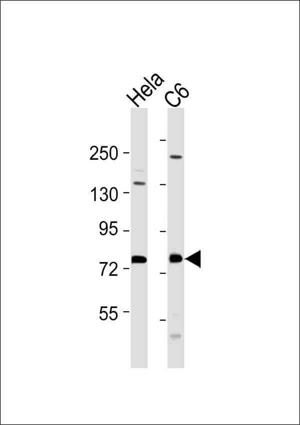 TLK1 Antibody
