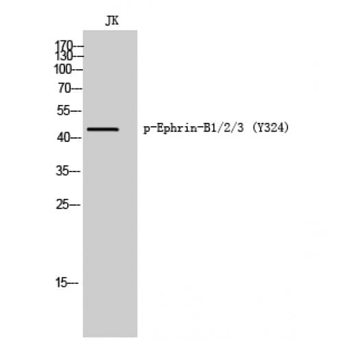 Polyclonal Rabbit anti-Human EPH Receptor B1+B2+B3 Antibody (260-340 aa, IHC, WB)