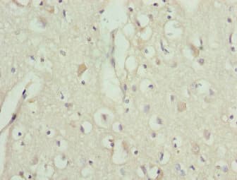 TRIM13 Antibody