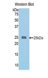 MMP12 Antibody (aa100-286)