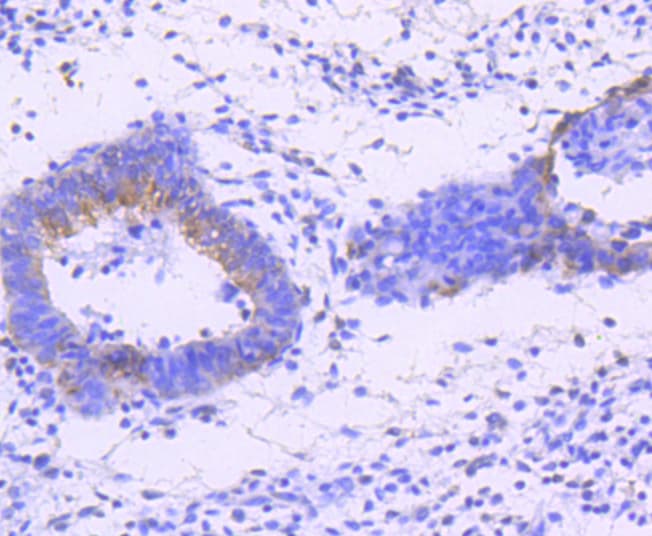 JNK1+2+3 Antibody (JNK1 phospho-Thr183 and JNK2 pThr183 and JNK3 pThr221)
