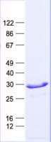 Human FBXO44 Protein (Recombinant His, N-Terminal)
