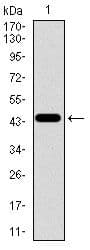 Monoclonal Mouse anti-Human Betaglycan / TGFBR3 Antibody (clone 1C5H11, Amino Acid: 147-328, WB)