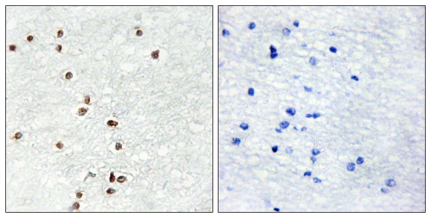 ZIC1+2+3 Antibody (Internal)