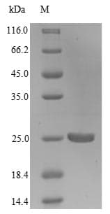 Legionella pneumophila MIP Protein (Recombinant 6His, N-terminus)