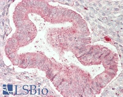 IHC-plus™ XPOT / Exportin-T Antibody (aa912-962)