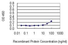 PRLR / Prolactin Receptor Antibody (clone 1E4)