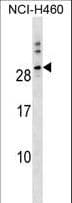 HTTY1 / TTYH1 Antibody (aa2-28)