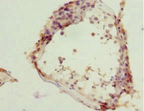 ZC3HC1 / NIPA Antibody