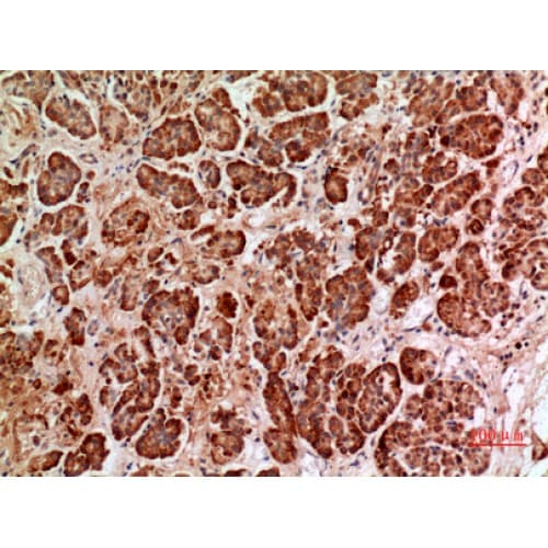 Polyclonal Rabbit anti-Human HPSE / Heparanase Antibody (241-290 aa, Internal, IHC, WB)