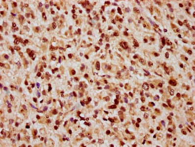 Polyclonal Rabbit anti-Human HIST1H2AI Antibody (IHC)