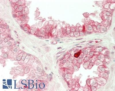 IHC-plus™ CA2 / Carbonic Anhydrase II Antibody (aa2-260)
