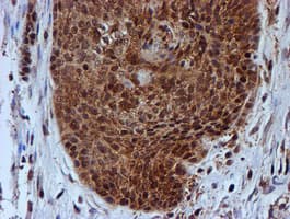 PSMB9 Antibody (clone OTI1G7)