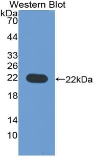 CD276 / B7-H3 Antibody (aa47-219, Biotin)