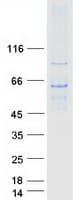 Human GHDC Protein (Recombinant Myc-DDK (Flag))