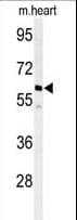 Polyclonal Rabbit anti-Human PPM1G Antibody (aa150-180, WB)