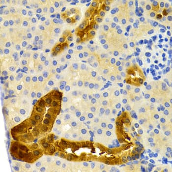 Polyclonal Rabbit anti-Human PVALB / Parvalbumin Antibody (IHC, WB)