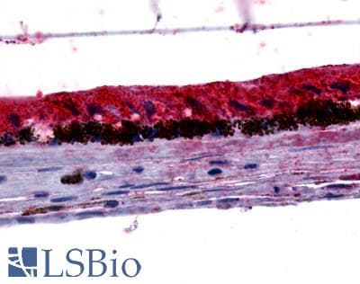 PathPlus™ GPR143 Antibody (C-Terminus)
