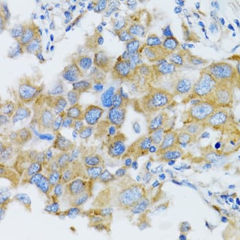 SIAH1 Antibody