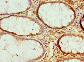 HMGN2 Antibody (aa1-90)
