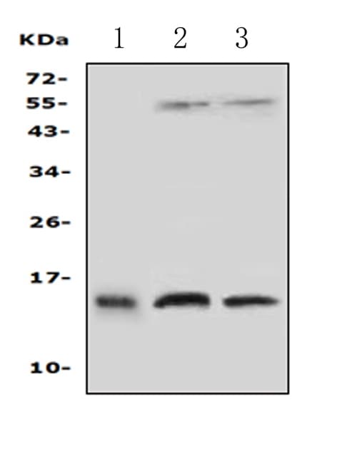 Polyclonal Rabbit anti-Human PFN2 / Profilin 2 Antibody (aa125-140, IHC, WB)
