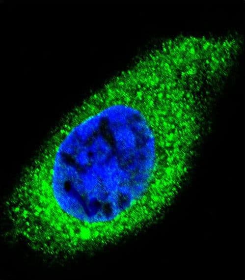 COL21A1 / Collagen XXI Antibody (aa204-232)