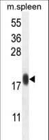 IMMP1L Antibody (aa100-127)