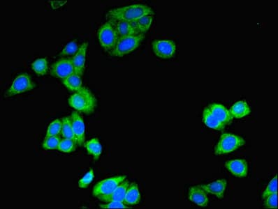 Amisyn / STXBP6 Antibody (aa2-210)