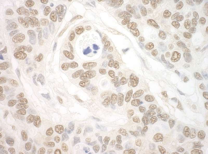 IPO7 / RANBP7 Antibody (aa50-100)