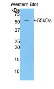 BACE2 Antibody (aa156-407)