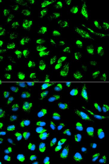 ECI1 / DCI Antibody