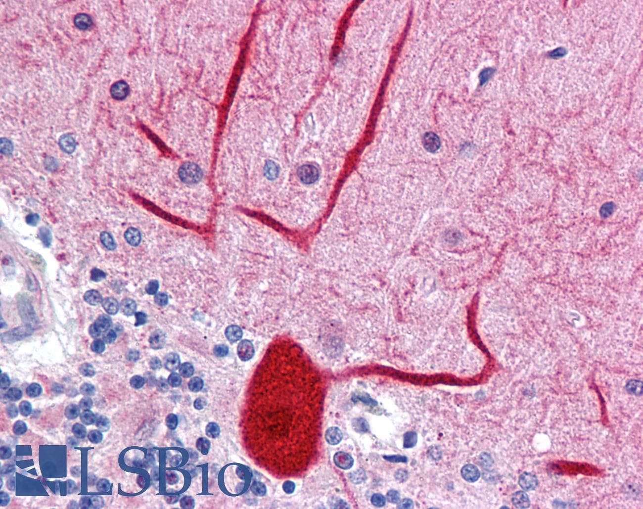 IHC-plus™ ENPEP / Aminopeptidase A Antibody