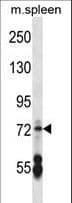 IHC-plus™ Polyclonal Rabbit anti-Human CNGA2 Antibody (aa190-218, IHC, WB)