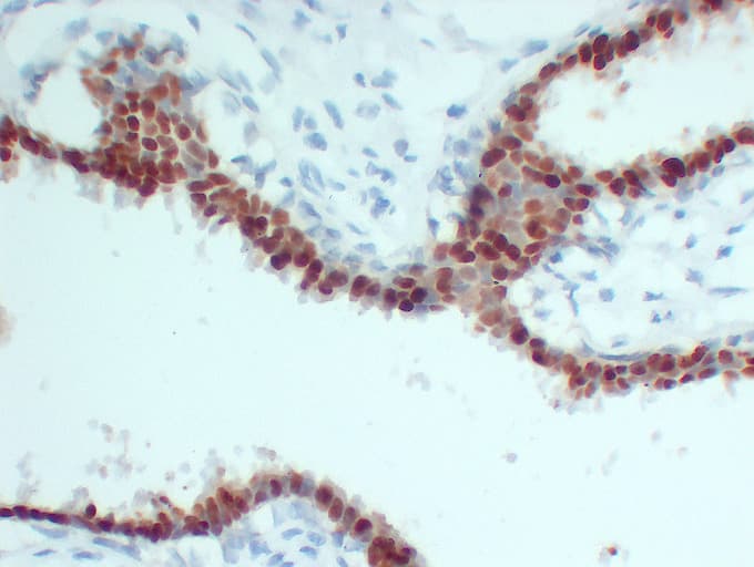 PR / Progesterone Receptor Antibody (clone ABT-PR)