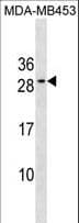 Polyclonal Rabbit anti-Human BCL2 / Bcl-2 Antibody (aa144-171, WB)
