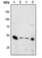 Polyclonal Rabbit anti-Human SYT1 + SYT2 Antibody (IHC, WB)