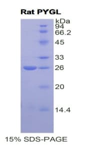 Rat PYGL Protein (Recombinant His)