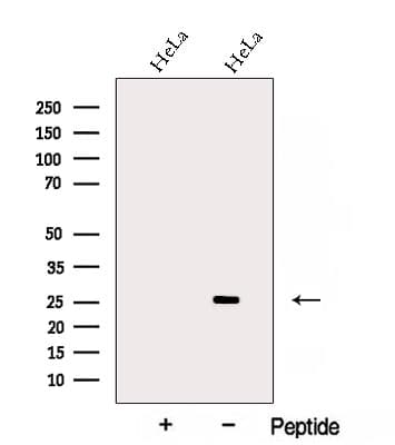 Polyclonal Rabbit anti-Human NAA10 / ARD1A Antibody (WB)