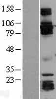 GRIPAP1 / GRASP1 Protein (Over-Expression Lysate Myc-DDK (Flag))