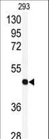 RFC3 Antibody (aa121-150)