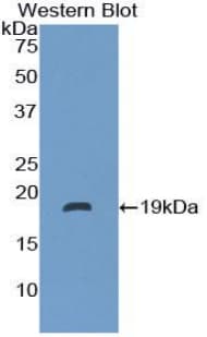 NTS / NT / Neurotensin Antibody (aa42-167)