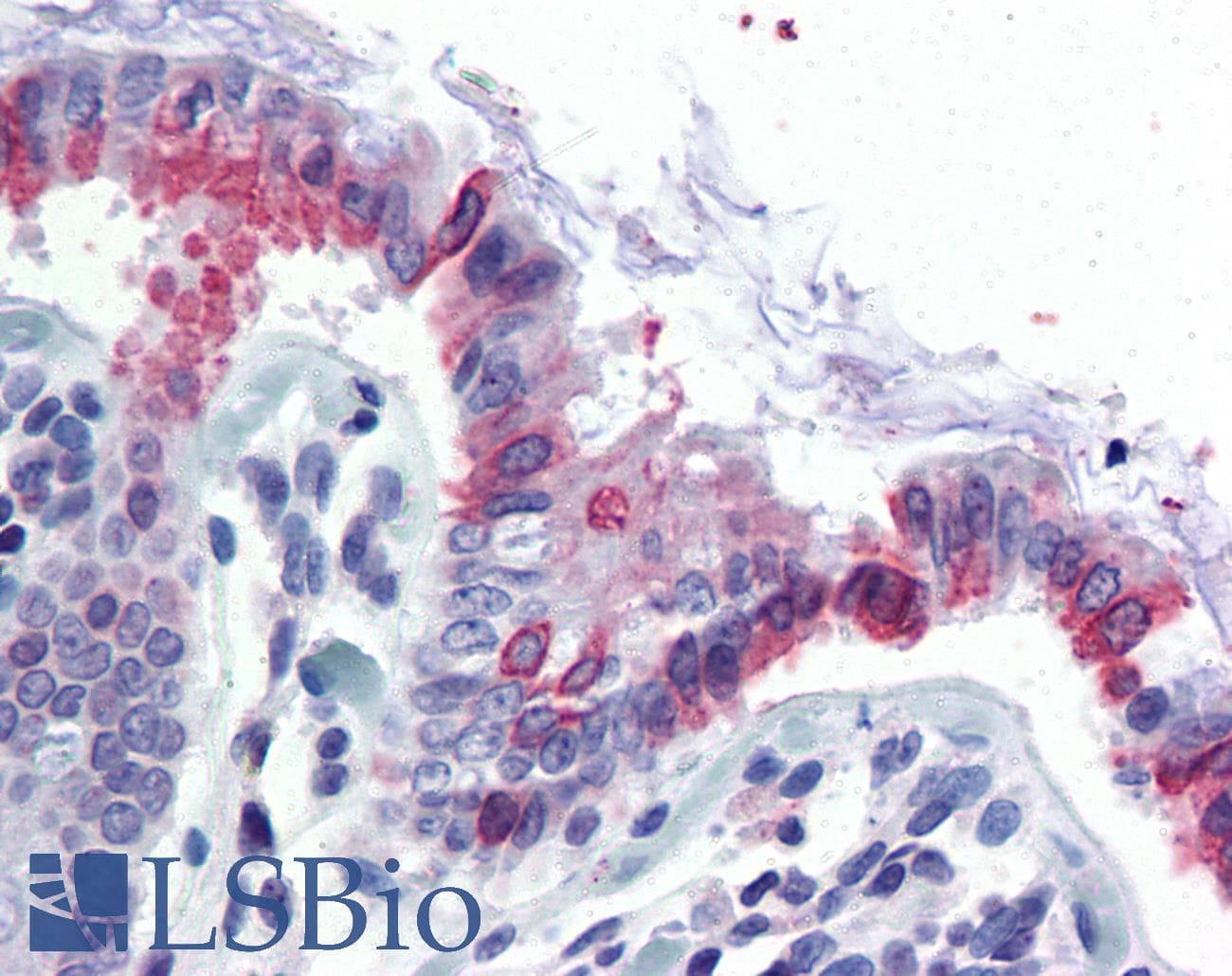 IHC-plus™ GCNT3 Antibody (N-Terminus)